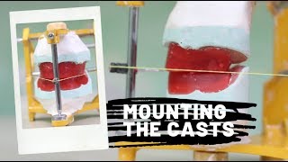 Mounting the casts on a mean value articulator  DEMO [upl. by Sitoel497]