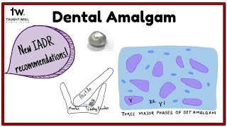 Dental Amalgam  New IADR recommendations  Dental Materials [upl. by Eiramave885]