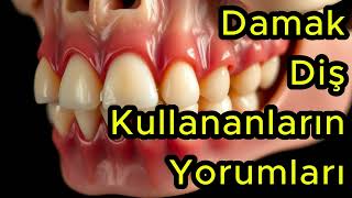 Damak Diş Kullananların Yorumları [upl. by Dnumsed]