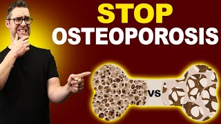 Top 7 Osteopenia amp Osteoporosis Treatments Symptoms amp Medications [upl. by Sharp]