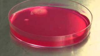 Yeast and mold mould growing in petri dish  Time Lapse [upl. by Dobson]