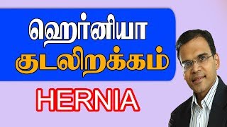 ஹெர்னியா குடலிறக்கம் தீர்வு Hernia Laparoscopy Surgery [upl. by Alaj390]