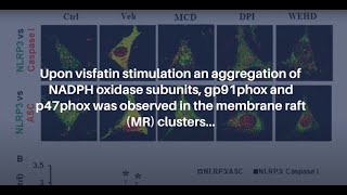 Membrane Raft Redox Signalling in VisfatinInduced Inflammasome Activation  AgingUS [upl. by Keffer604]