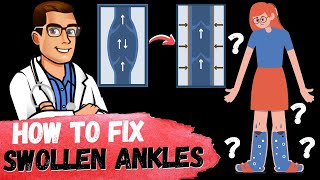 How to Get Rid of Swollen Ankles amp Swollen Legs FAST Causes amp Fixes [upl. by Atorod252]