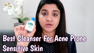 Best Face Cleanser for Acne Prone Sensitive Skin  Cetaphil Face amp Body Gentle Skin Cleanser Review [upl. by Eihpos91]