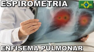 ESPIROMETRIA  DIAGNÓSTICO DE ENFISEMA PULMONAR  Teste de Função Pulmonar [upl. by Einehpets]