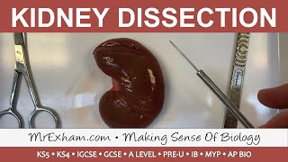 Kidney Dissection  GCSE A Level IB [upl. by Ydnyc]