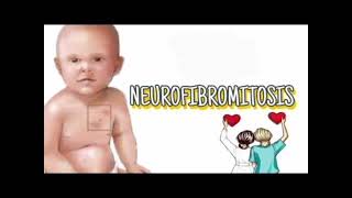 Neurofibromatosis History mrcpch Clinical [upl. by Haley]