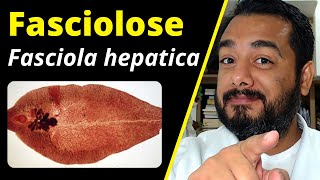 Fasciolose Fasciola hepatica o que é ciclo sintomas diagnóstico  Curso de Parasitologia [upl. by Zehe410]