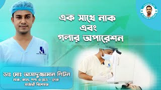 একইসাথে রোগীর নাক এবং গলার অপারেশন । Tonsillectomy। Septoplasty । Dr Assaduzzaman Liton [upl. by Furey]