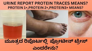 PROTEIN PRESENTTRACES IN URINE CAUSES SYMPTOMS AND TREATMENT OF PROTEIN IN URINE IN KANNADA [upl. by Julis197]