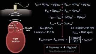 The Bernoulli Equation  Medical Applications Fluid Mechanics  Lesson 8 [upl. by Azarria]