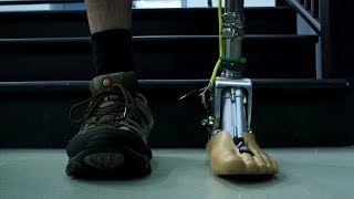 Smart prosthetic ankle takes fear out of rough terrain stairs [upl. by Aniger]