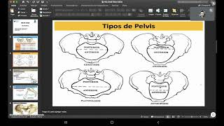 CLASE 8  OBSTETRICIA  PELVIMETRIA [upl. by Ratcliff]