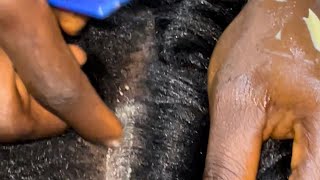 ASMR Greasing scalp Dandruff check and chewing gum Satisfying [upl. by Maitund694]