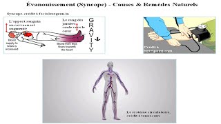 La SyncopeCauses et Remèdes Naturels [upl. by Oicnerolf825]