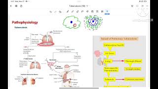 Tuberculosis pathophysiology  investigation amp treatment [upl. by Ianaj]