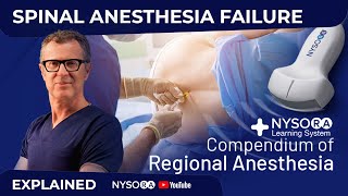 SPINAL ANESTHESIA FAILURE  Crash course with Dr Hadzic [upl. by Faludi440]