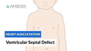 Ventricular Septal Defect VSD  Heart Auscultation  Episode 11 [upl. by Ause]