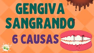 GENGIVA SANGRANDO causas e tratamentos para sangramento gengival [upl. by Beaufort]