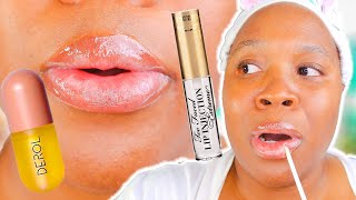 I Tried Every Popular LIP PLUMPER For 5 days 👄 [upl. by Laura263]