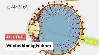 Akutes Winkelblockglaukom bei Pupillarblock  AMBOSS Video [upl. by Allekram]