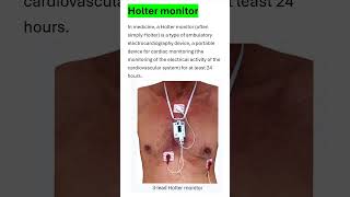 Holter monitor  medicaleducation nursing mbbs cardiacsystem [upl. by Grosz572]