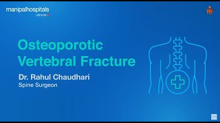 Osteoporotic Vertebral Fracture  Dr Rahul Chaudhari  Manipal Hospital Baner [upl. by Neit]