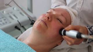 Naaldloze mesotherapie en elasticiteit huid herstellen [upl. by Eerised404]