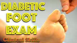 Diabetic Foot Examination  Clinical Skills  Dr Gill [upl. by Pyle]