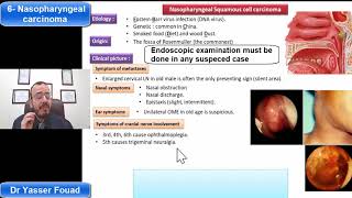 6 Nasopharyngeal Carcinoma [upl. by Alia577]