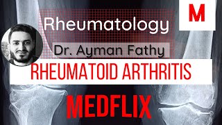 Rheumatoid Arthritis  Dr Ayman fat7y  Medflix  USMLE🖤 [upl. by Loraine]