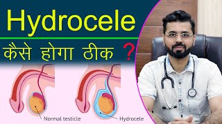 Hydrocele कैसे होगा ठीक   How to treat Hydrocele [upl. by Akimas948]