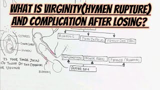 What Is VirginityRupture HymenAnd ComplicationSignSymptoms After It [upl. by Harvey867]