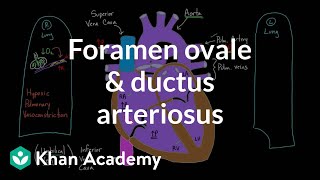 Foramen ovale and ductus arteriosus  Circulatory system physiology  NCLEXRN  Khan Academy [upl. by Lecroy]