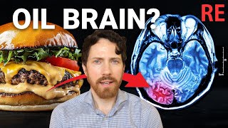 The 212 Billion Dollar Food ingredient poisoning your Brain RE What Ive Learned [upl. by Pancho]