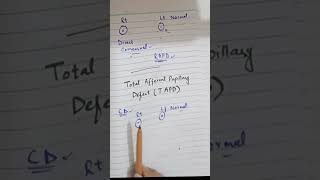 How to Diagnose Total Afferent Pupillary Defect TAPD With These Easy Steps  Eye Lectures MBBS [upl. by Glover]