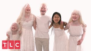 The Grabowskis Unique Adoption Story Part 2  Born With Albinism [upl. by Placida]