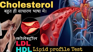 Cholesterol lipid profile testLDLHDL in Hindiby DOCTORLab [upl. by Ellenaj]