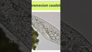 Paramecium part 11 bihar biology paramecium paramecium caudatum Bihar university zoology [upl. by Ahsaetan]