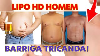 LIPO HD EM HOMENS [upl. by Lowery]