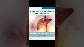 Esteatosis hepática metabólica [upl. by Lever203]