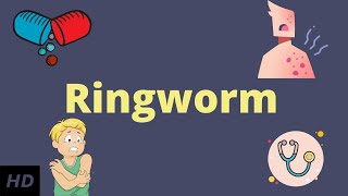 Ringworm Causes Signs and Symptoms Diagnosis and Treatment [upl. by Placeeda]