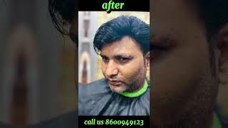 Nagpurs Premier Hair Patch Solutions Transform Your Look with Expert Hair Solutions hairstyle [upl. by Nashbar]