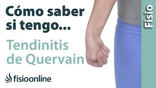 Cómo saber si tienes TENDINITIS de QUERVAIN o tendinitis del pulgar [upl. by Chenay]