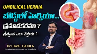 Umbilical Hernia Causes  Umbilical Hernia Symptoms  Umbilical Hernia Treatment  Dr Ujwal Gajula [upl. by Mauri]