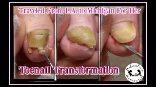 Pedicure Tutorial Satisfying Toenail Transformation [upl. by Eppillihp]