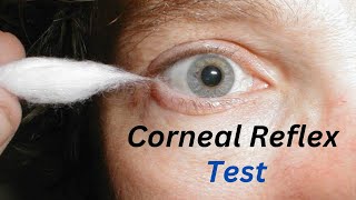 what is the corneal reflex  Corneal Sensation  blink reflex  Assessment of corneal reflex test [upl. by Neelie]