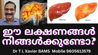 കരൾ രോഗങ്ങൾ  Dr Xavier Reveals Ayurvedic SECRETS for Liver Health [upl. by Grady]