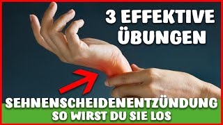 SEHNENSCHEIDENENTZÜNDUNG  mit DIESEN 3 ÜBUNGEN wirst DU sie schnell los [upl. by Casilde463]